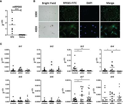 Inhibiting TLR7 Expression in the Retinal Pigment Epithelium Suppresses Experimental Autoimmune Uveitis